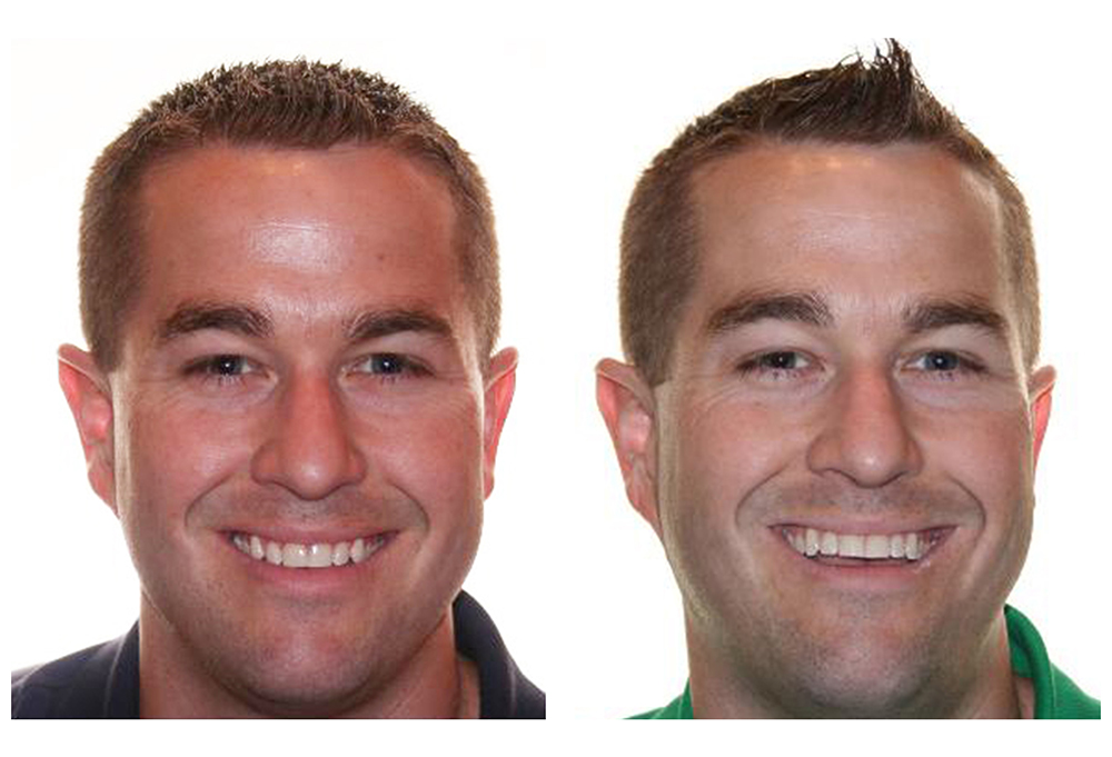 Jolly Family Dental - Benton