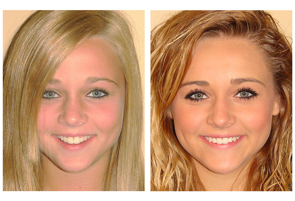 Jolly Family Dental - Benton